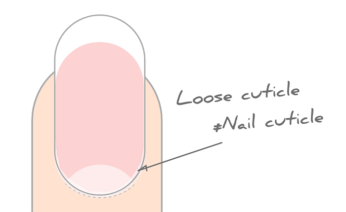 The Dangers of Nail Infections